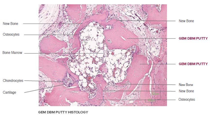 GEM-Putty-Histology